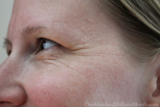 why do pugs get pimples does rodan fields really work why do pugs get pimples does rodan fields really work