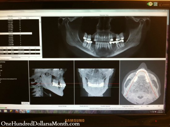 Mavis and the Case of the Crappy British Teeth Part 2